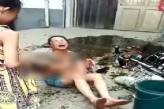 電動(dòng)車撞翻早餐攤油鍋，1歲半男娃被熱油從頭澆下[多圖]