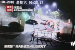 男子圍觀情侶吵架，被咬掉鼻尖，情侶間如何避免吵架？[多圖]