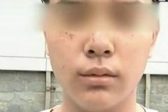 打籃球13歲少年被抓成花臉，如何解決廣場(chǎng)舞擾民問題[多圖]