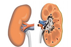腎炎該怎么治療最好？腎炎有傳染性嗎？[圖]