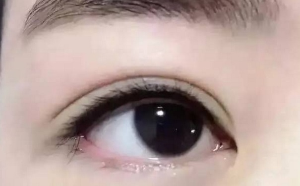 美瞳線對眼睛有什么壞處？美瞳線對眼睛有副作用嗎？(1)