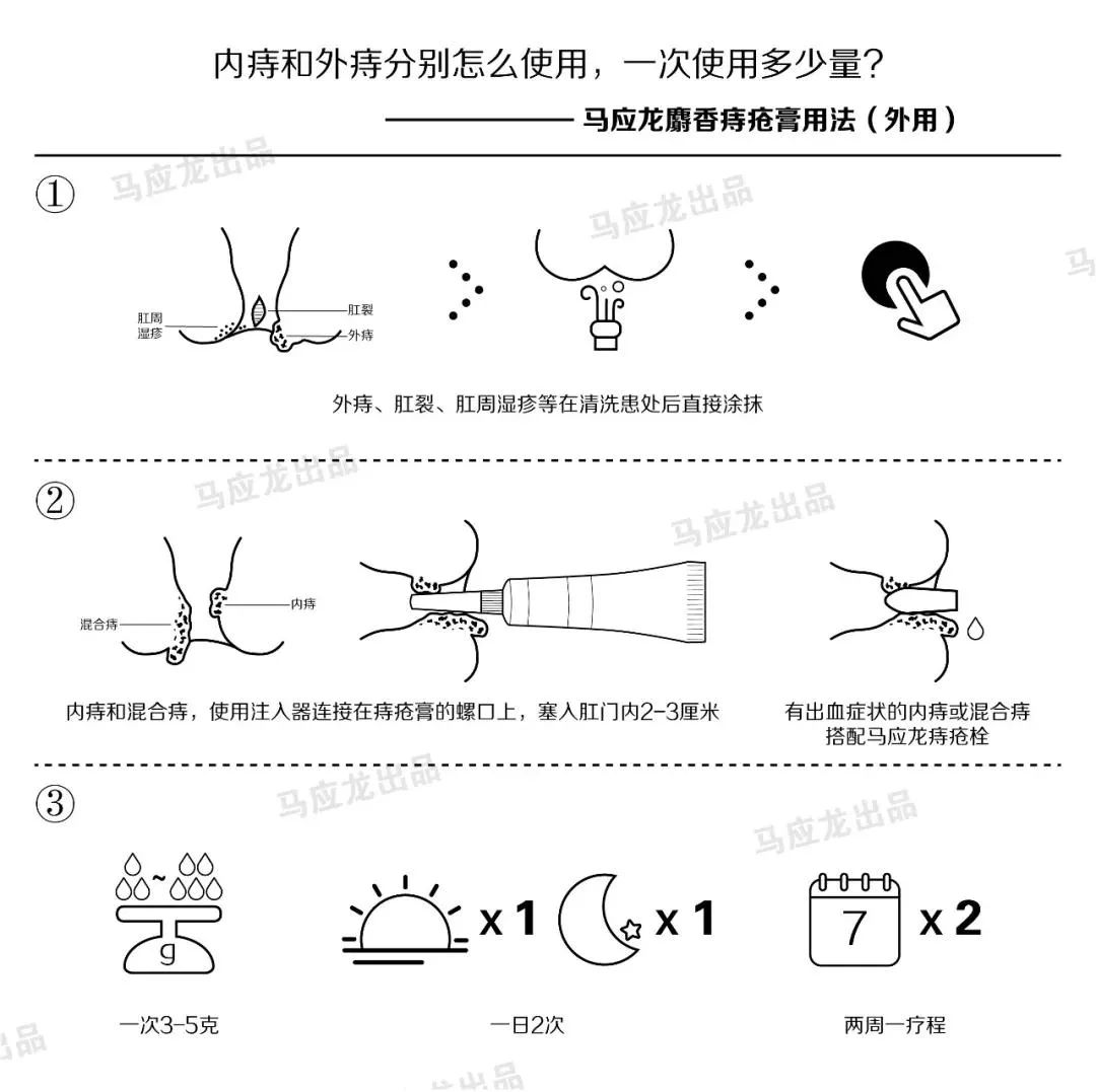 武漢馬應(yīng)龍肛腸醫(yī)院正規(guī)靠譜 專業(yè)高效