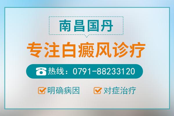 南昌國(guó)丹醫(yī)院怎么樣？治療白癜風(fēng)正常大概花多少錢？