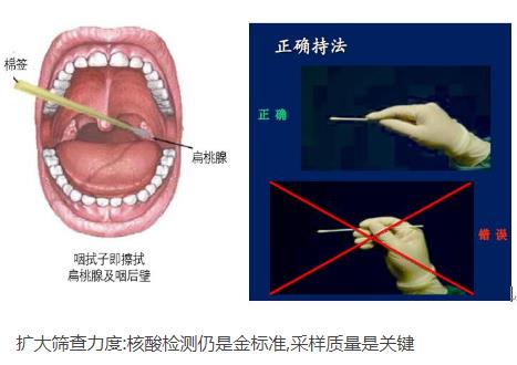 核酸檢測新冠病毒的常用手段：口腔拭子、鼻腔拭子檢測圖解