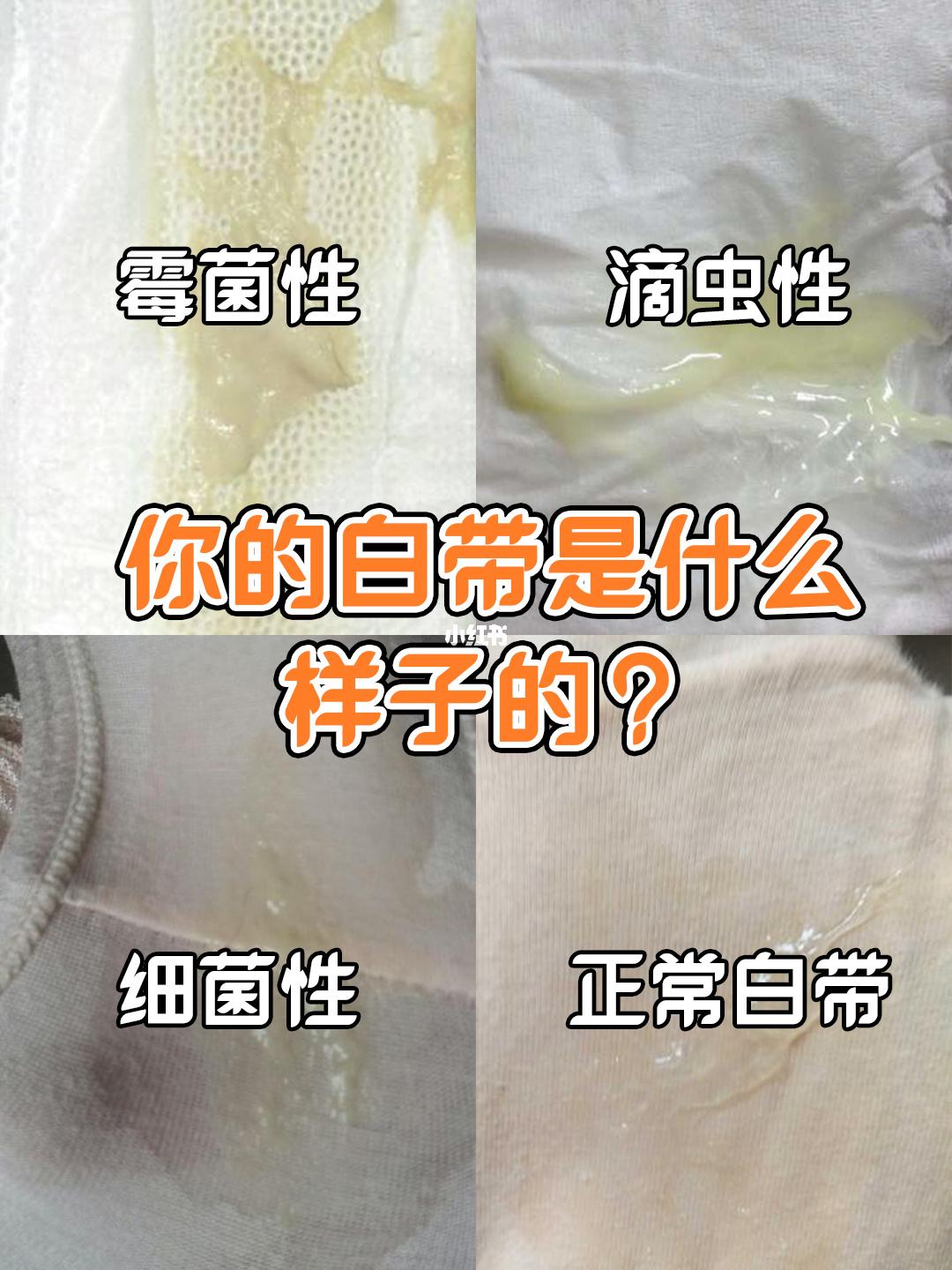 白帶各種癥狀圖片大全