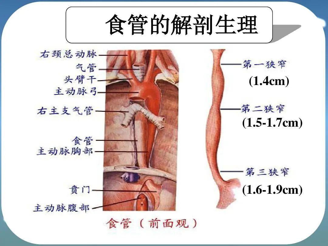 廣州復大腫瘤醫(yī)院案例998：為食管癌患者打開“生命通道”