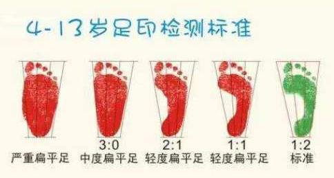 扁平足能跑步嗎？扁平足跑步有什么危害？