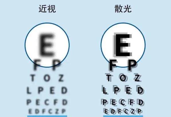 散光的癥狀有哪些？散光可以戴隱形眼鏡嗎？