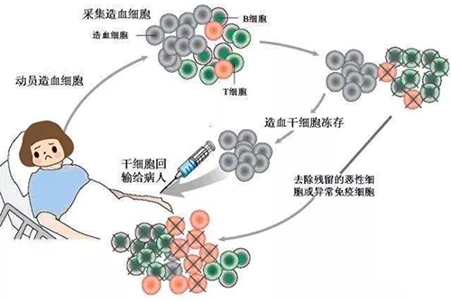 濟(jì)南血液病醫(yī)院科普：患者確診骨髓瘤應(yīng)該怎么辦？