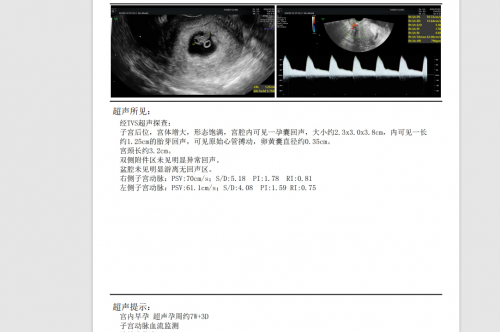 年近不惑苦求二胎，陳怡主任幫她圓夢升級