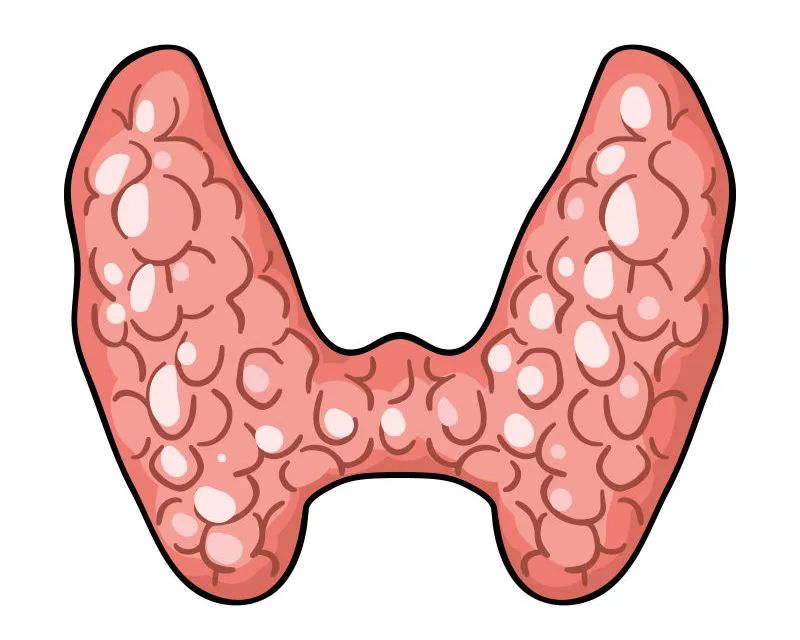 當心！成都民生耳鼻喉醫(yī)院：身體有這幾種表現(xiàn)，說明你的甲狀腺出了問題！