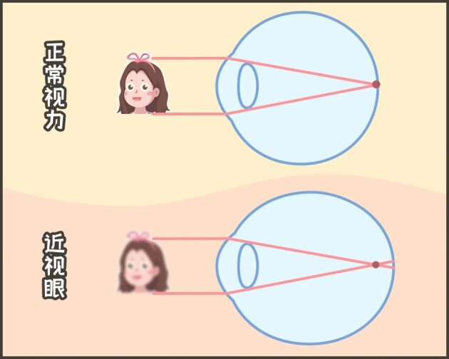 合肥愛(ài)爾：「我可以治好你的近視，但不改變度數(shù)?！股?？