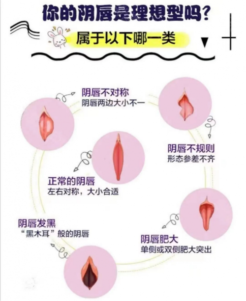 昆明做陰唇整形會留疤嗎？多久能恢復(fù)呢？