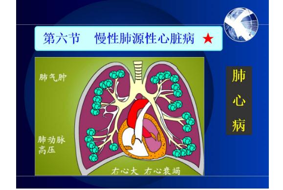 冠心病是心臟病嗎？什么是肺源性心臟病？