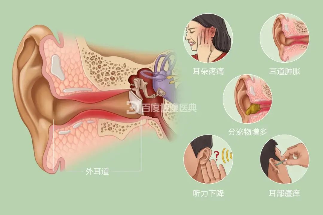 兒童患”流感“為什么會(huì)耳朵疼？成都民生耳鼻喉醫(yī)院專家解答原因 國家三級(jí)醫(yī)院