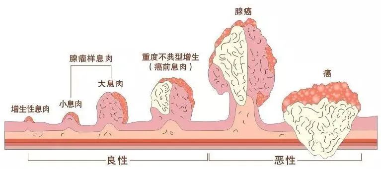  揚州妙手醫(yī)院睡眠式無痛胃腸鏡檢查，不僅準確，而且“快速”