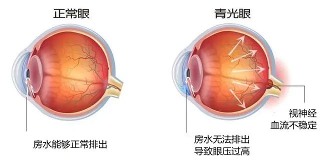 株洲愛爾代敏丨為“獨眼”女子守住最后一絲光明！