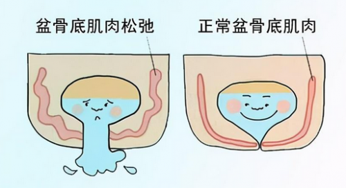 在昆明關(guān)于陰道松弛，你一定要知道的這些問題