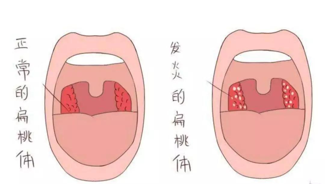 成都民生耳鼻喉醫(yī)院一大波優(yōu)惠活動(dòng)來(lái)襲！耳鼻喉內(nèi)窺鏡檢查免費(fèi)，預(yù)約從速！