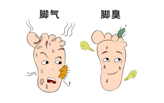 小孩得腳氣了應該怎么辦？襪子會傳染腳氣嗎？