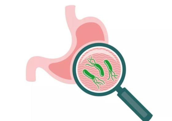 幽門螺桿菌怎么才能根除 治療幽門螺桿菌掛什么科