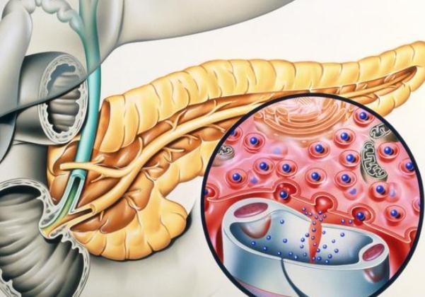 胰腺癌到底有多可怕？ 哪些人容易得胰腺癌？