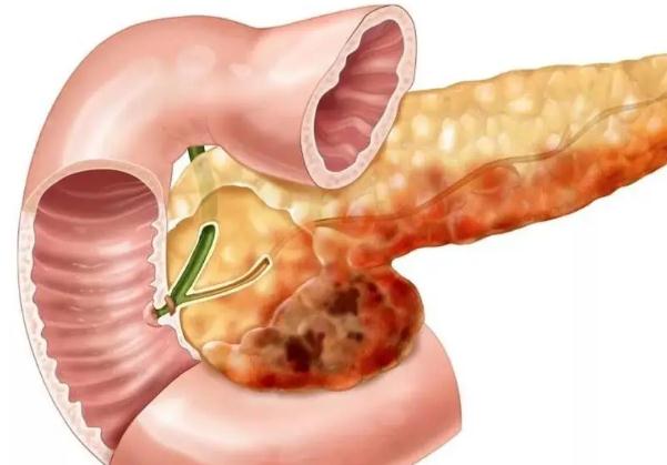 胰腺炎為什么不能喝水？狗狗胰腺炎能治好嗎？