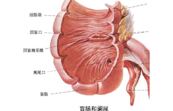 急性闌尾炎化膿嚴重嗎 闌尾炎的體征有哪些