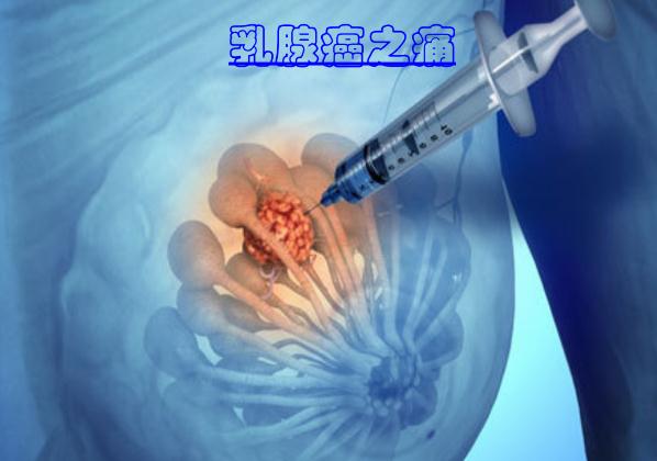 這些食物可以預(yù)防乳腺癌 ？乳腺癌手術(shù)后多久化療？