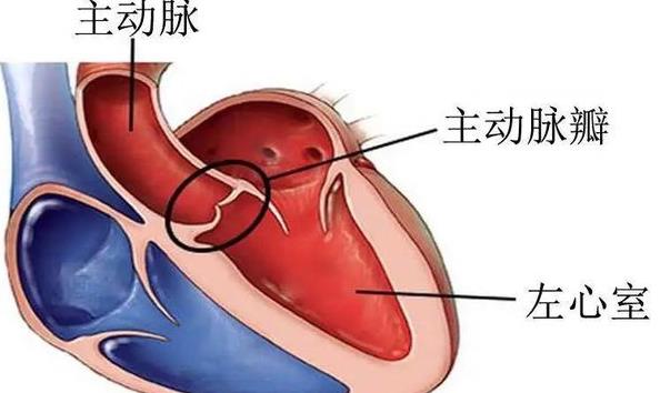 做心臟瓣膜術(shù)后嗓子疼怎么辦 加強(qiáng)生活管理服用藥物