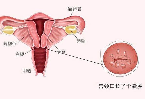 宮頸癌疫苗間隔多長(zhǎng)時(shí)間 打人乳頭瘤疫苗注意什么