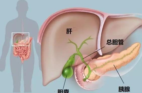 膽結(jié)石可以吃蛋白嗎 問(wèn)膽結(jié)石可以吃巧克力嗎