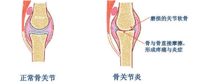 優(yōu)得寧和西樂(lè)葆的區(qū)別揭秘：看著相似，實(shí)則大有不同